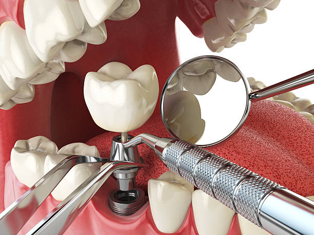 Best Emergency Denture Repair in North Bennington, VT